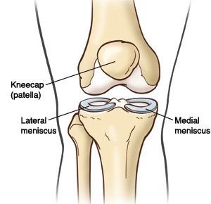 Diagram of the medial meniscus and lateral meniscus in the knee